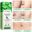 BIOAQUA Centella Asiatica Soothing Repair Facial Serum Nourish Oil Control Anti-Acne Face Skin Care 30ml image