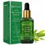 BREYLEE Acne Treatment Serum - 17ML image