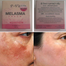 P Vita Melasma Mesta Whitening Cream -10 gm (Thailand) image