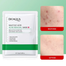 Bioaqua Salicylic Acid Acne Removal Sheet Mask 25 gm image