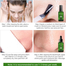 Breylee Tea Tree Blackhead Kit 3in1 Set image