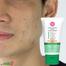 Cathy Doll Acne Solution Serum Foam Cleanser - 100ml image
