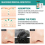Disunie Deep Cleansing Bamboo Charcoal Black head Nose Pore 10 Pcs image