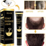 EELHOE Natural Hair Growth Serum Prevent Baldness Scalp Treatment Antiloss Hair Growth Essence Nourishing Hair Serum Roller 20ml image