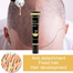 EELHOE Natural Hair Growth Serum Prevent Baldness Scalp Treatment Antiloss Hair Growth Essence Nourishing Hair Serum Roller 20ml image