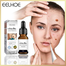 Eelhoe Active Skin Mole Remover - 10 ml image