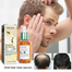 Eelhoe Biotin Fast Hair Growth Oil Hair Regrowth Serum Prevent Baldness Scalp Massage Treatment Hair Growth - 45 ml image