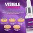 Episoft Hair Removal Inhibitor Serum- 30 ML image