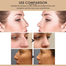 JAYSUIING NOSE DEFINING SERUM - 30ml image