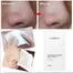 LANBENA Aloe Deep Cleansing Nose Strips - 1 Pcs image