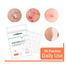 Lanbena Acne Pimple Patch 25 Patches image