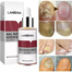 Lanbena Nail Repair Essence Serum - Fungal Treatment 3Pcs image