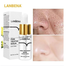 Lanbena Pore Treatment Serum image