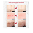 Lanbena Tcm Scar Removal Set - 3pcs (Combo) image