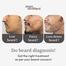 Man Matters BeardMax 5percent Minoxidil Beard Growth Serum - 30ml -343677690 image