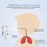 Mesh Nebulizer (YM-252) image
