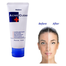Mistine Acne Clear Facial Foam Face Wash - 85 gm | Made In Thailand image