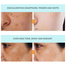Dark Spot Remover Cream – Face Brightening and Freckle Removal Treatment (30gm) image