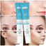 Mooyam Salicylic Acid Remove Acne Gel 20 gm image