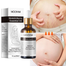 Mooyam Stretch Marks Essential Oil-30ml image