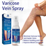 OUHOE Varicose Vein Spray 30ml image