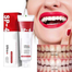SP-4 Whitening Probiotic Toothpaste image