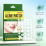 Sadoer Extra Strong Acne Patch With Salicylic Acid And Hydrocolloids 2 Size Types 36Pcs image