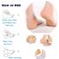 Silicone Gel Heel Pad Socks For Heel Swelling Pain Relief Dry Hard Cracked Heels Repair Cream Foot Care Ankle Support Cushion - For Men And Women Set Of 2 image
