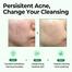 Some By Mi Aha Bha Pha 30 Days Miracle Cleansing Bar image