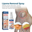 South Moon Lipoma Removal Spray (50ml/1.69fl oz) image