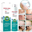South Moon Medical Grade Scar Spray 20g image
