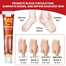 Sumifun Leg Edema Relief Cream 20Gm image