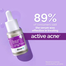 The Derma Co 2 Percent Salicylic Acid Face Serum 10 ml image