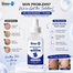 The Derma Plus 10 percent Niacinamide plus 1 percent Zinc Face Serum – 30 ml image