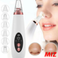 USB Rechargeable Multifunctional Blackhead Remover image