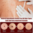 West And Month Tags And Moles Remover-3ml image