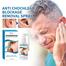 eelhoe ANTICHOCHLEAR Blockage Removal Spray - 30ml image